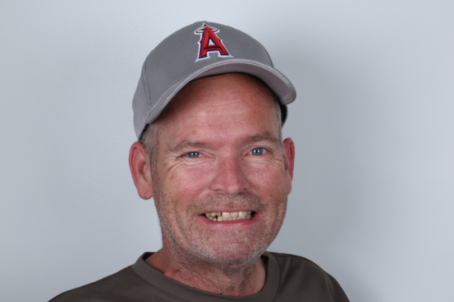 All-on-4 with bone loss: Before All-on-4 dental implants showing missing and damaged teeth with visible bone loss