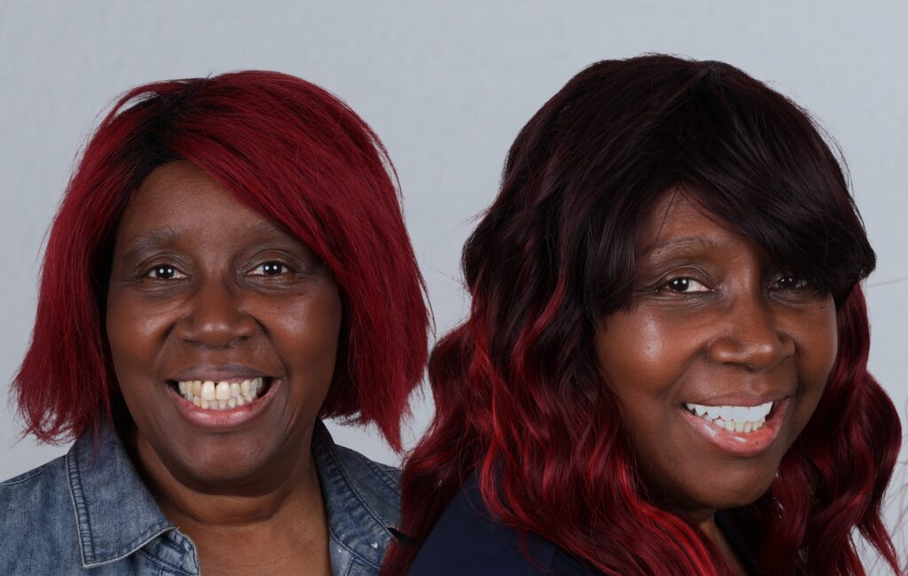 Dental Implants with Gum Disease: Can You Still Get Them?